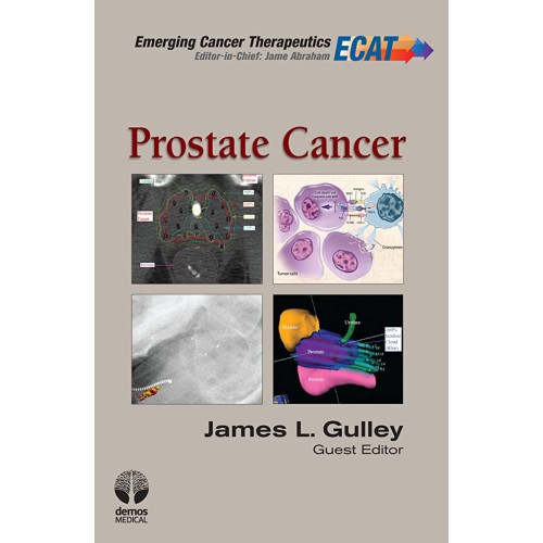 Prostate Cancer Emerging Cancer Therapeutics ...