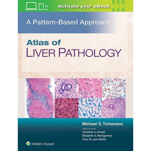 Atlas Of Liver Pathology A Pattern Based Appr...