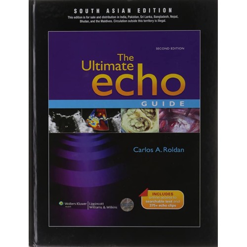 The Ultimate Echo Guide 2Ed: With Solution Ac...