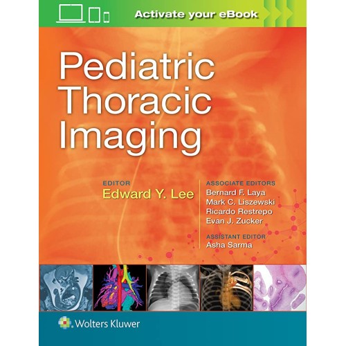 Pediatric Thoracic Imaging (Hb 2019) 