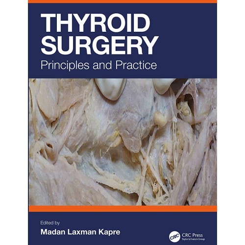 Thyroid Surgery Principles And Practice (Hb 2...