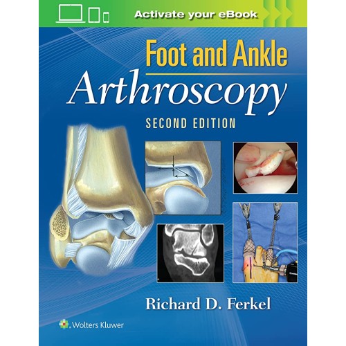 Foot And Ankle Arthroscopy 2Ed (Hb 2017) 