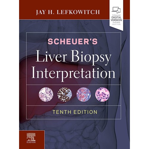 Scheuers Liver Biopsy Interpretation 10Ed (Hb...