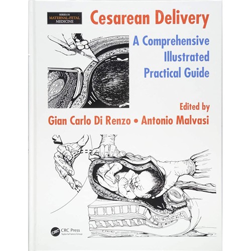 Cesarean Delivery A Comprehensive Illustrated...