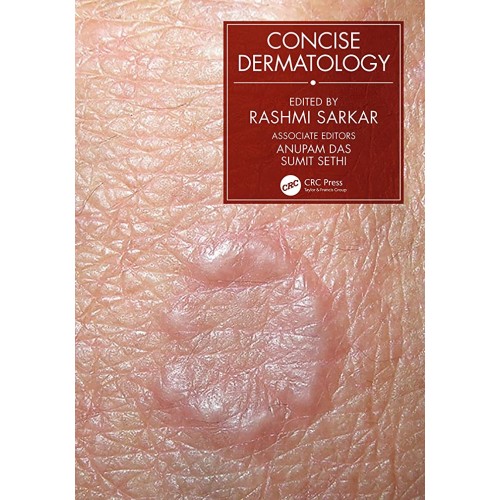 Concise Dermatology (Pb 2021)