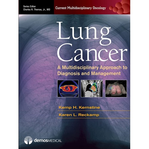 Lung Cancer A Multidisciplinary Approach To D...