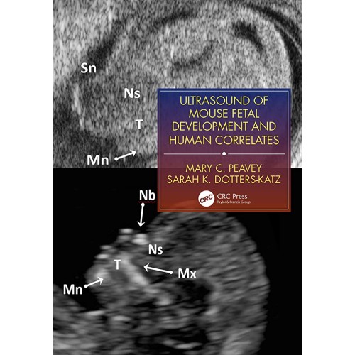 Ultrasound Of Mouse Fetal Development And Hum...