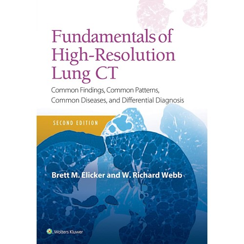 Fundamentals Of High Resolution Lung Ct Commo...