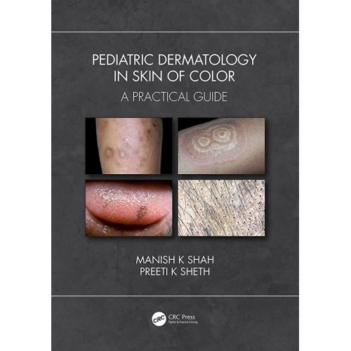 Pediatric Dermatology In Skin Of Color A Prac...