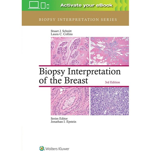 Biopsy Interpretation Of The Breast 3Ed (Hb 2...