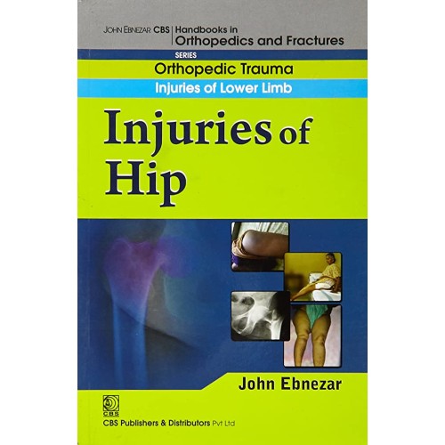 Injuries Of Hip (Handbook Of Orthopedics And ...