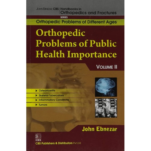 Orthopedic Problems Of Public Health Importan...