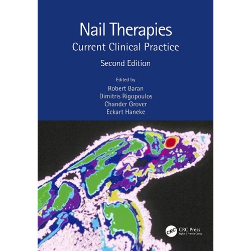 Nail Therapies Current Clinical Practice 2Ed ...