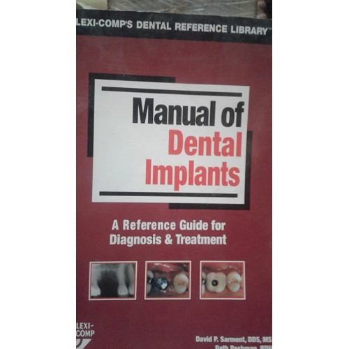 Manual Of Dental Implants  A Reference Guide ...