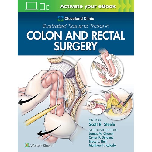 Cleveland Clinic Illustrated Tips And Tricks ...