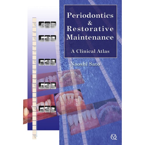 Periodontics & Restorative Maintenance: A Cli...