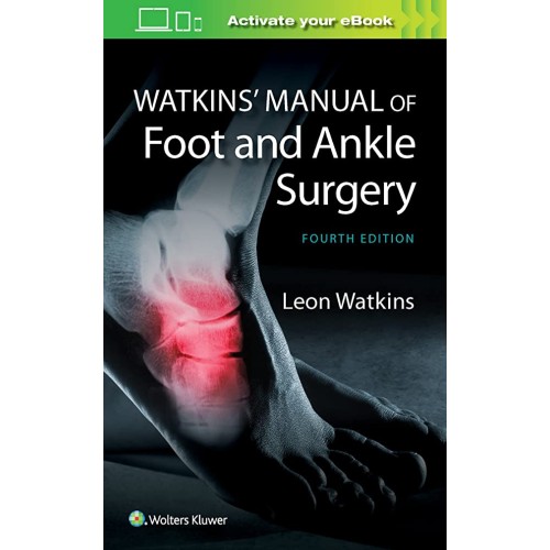 Watkins Manual Of Foot And Ankle Surgery 4Ed ...