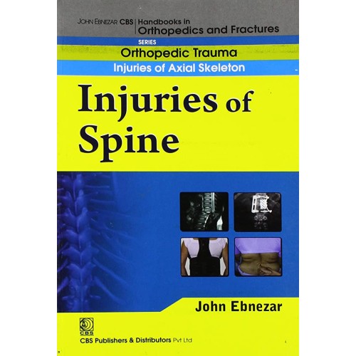 Injuries Of Spine (Handbook Of Orthopedics An...