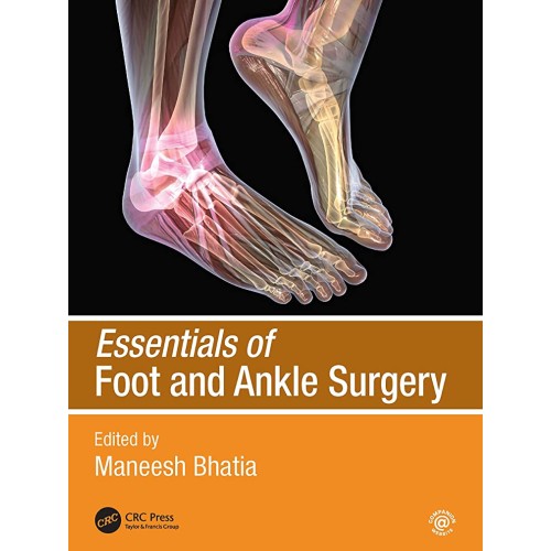 Essentials Of Foot And Ankle Surgery (Pb 2021...