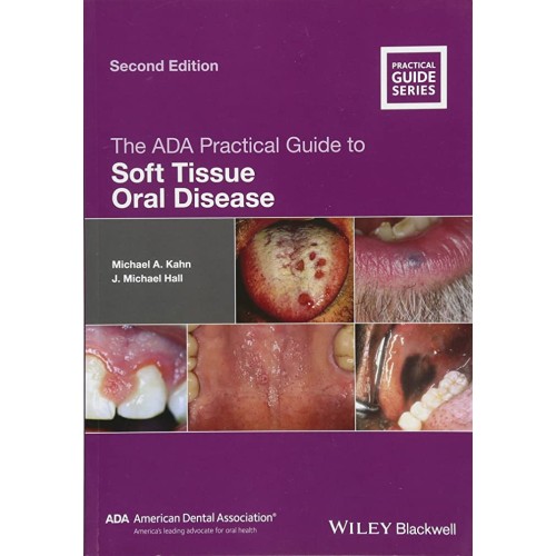 The Ada Practical Guide To Soft Tissue Oral D...