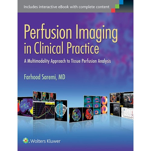 Perfusion Imaging In Clinical Practice A Mult...