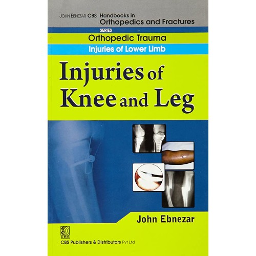 Injuries Of Knee And Leg (Handbook In Orthope...