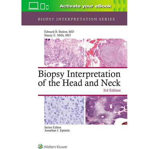 Biopsy Interpretation Of The Head And Neck 3E...