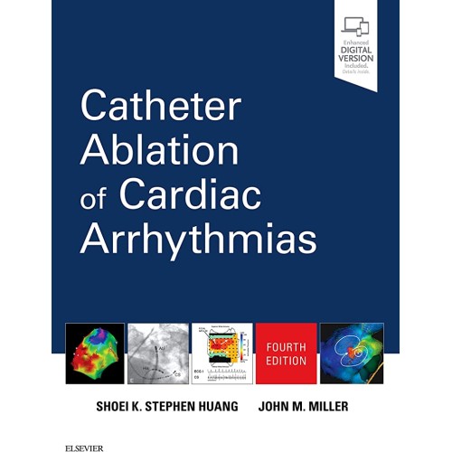 Catheter Ablation Of Cardiac Arrhythmias With...