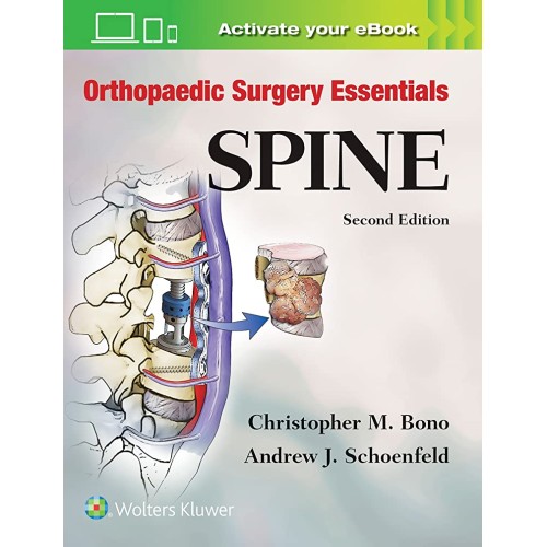 Orthopaedic Surgery Essentials Spine 2Ed (Hb ...