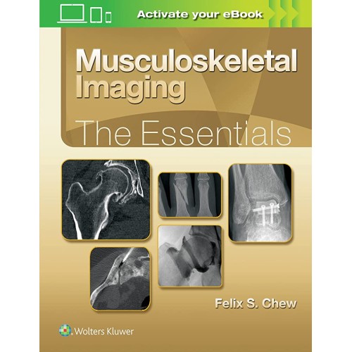 Musculoskeletal Imaging The Essentials (Hb 20...