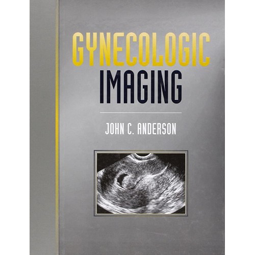 Gynecologic Imaging 