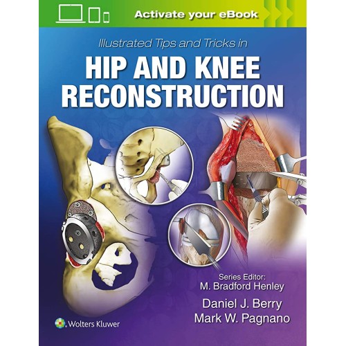 Illustrated Tips And Tricks In Hip And Knee R...