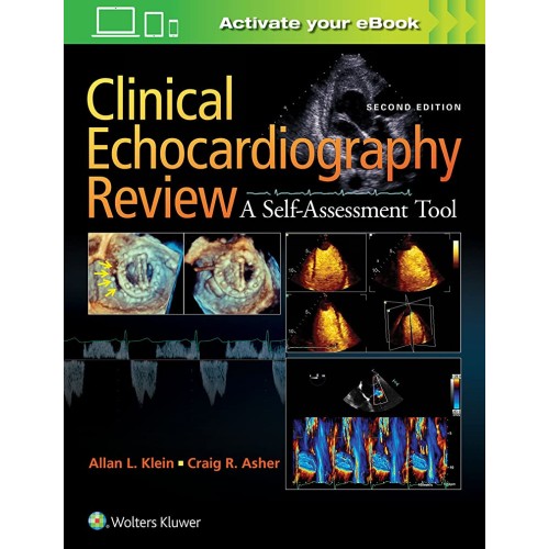 Clinical Echocardiography Review A Self Asses...