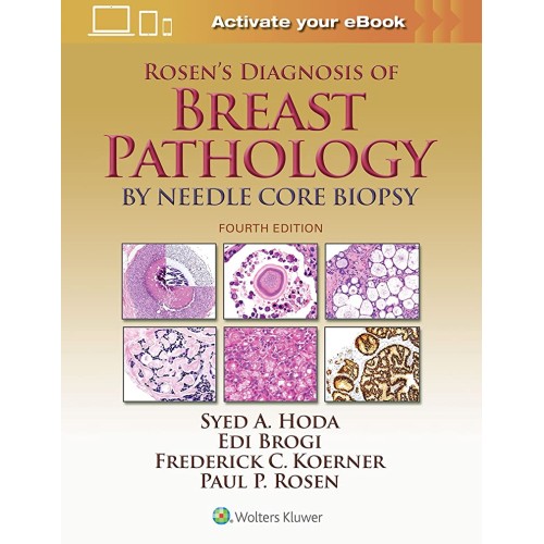 Rosens Diagnosis Of Breast Pathology By Needl...