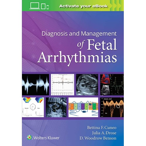 Diagnosis And Management Of Fetal Arrhythmias...