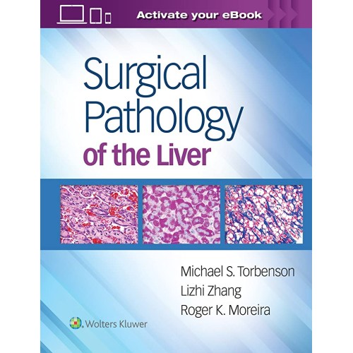 Surgical Pathology Of The Liver (Hb 2018) 