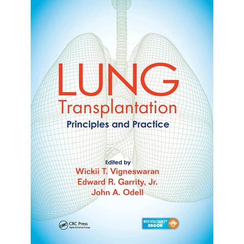 Lung Transplantation Principles And Practice ...