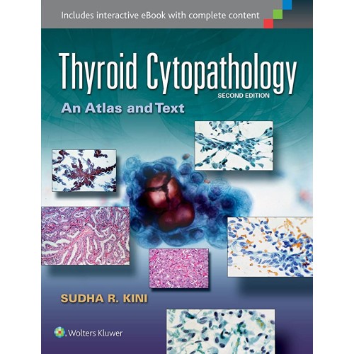 Thyroid Cytopathology An Atlas And Text 2Ed (...