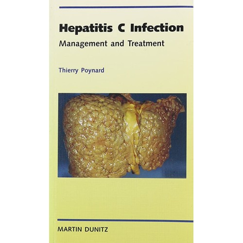 Hepatitis C Infection: Management And Treatme...