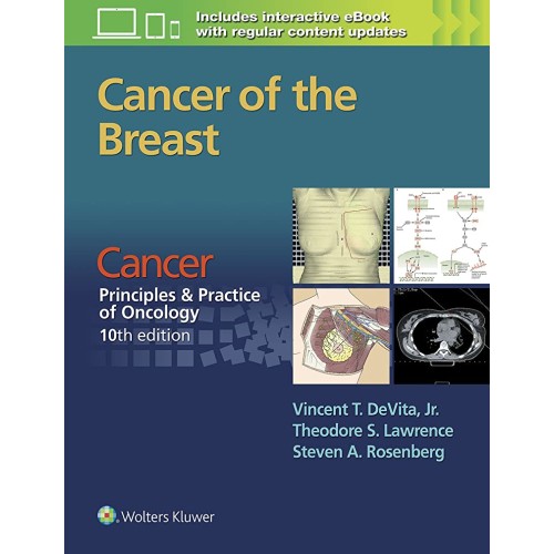 Cancer Of The Breast Cancer Principles And Pr...