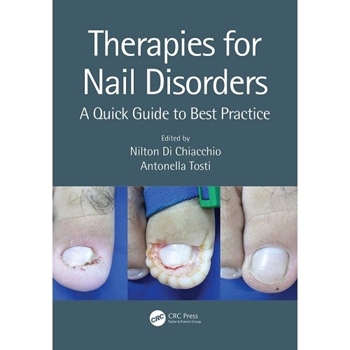 Therapies For Nail Disorders A Quick Guide To...