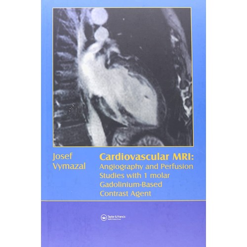 Cardiovascular Mri : Angiography And Perfusio...