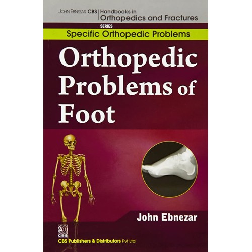 Orthopedic Problems Of Foot (Handbooks In Ort...