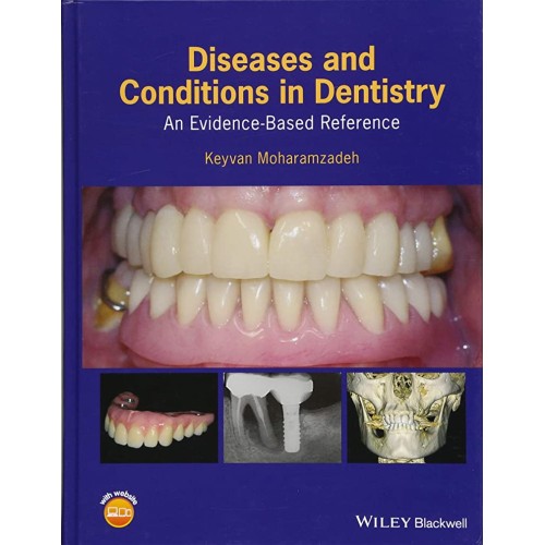 Diseases And Conditions In Dentistry An Evide...