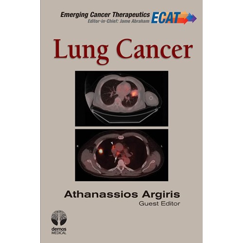 Lung Cancer (Hb 2012) 