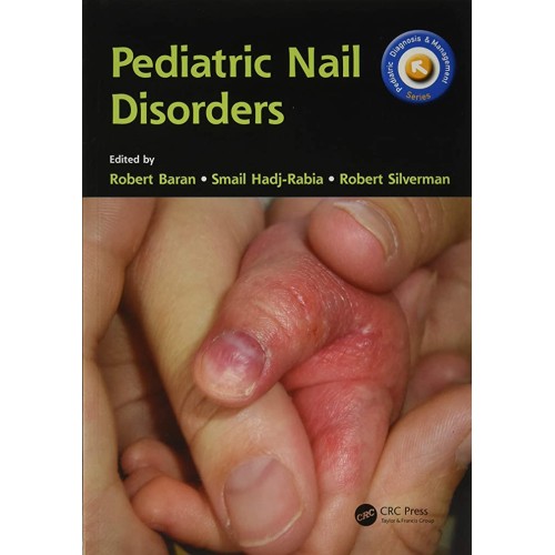 Pediatric Nail Disorders (Pb 2017) 