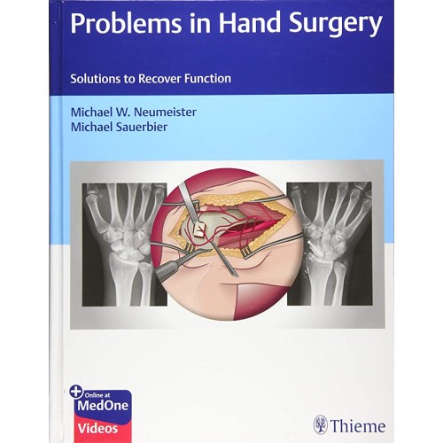 Problems In Hand Surgery Solutions To Recover...