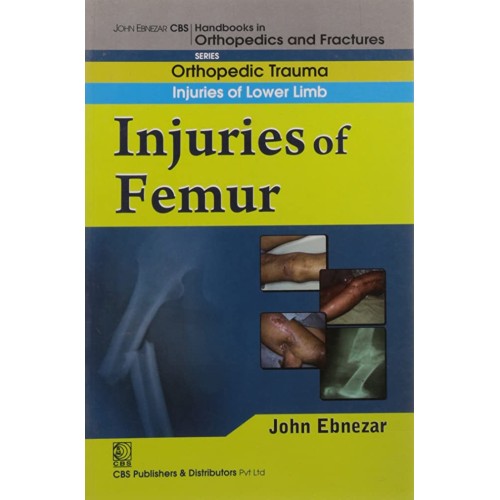 In Juries Of Femur (Handbook In Orthopedics A...