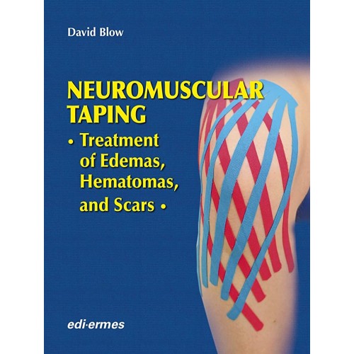 Neuromuscular Taping Treatment Of Edemas Hema...