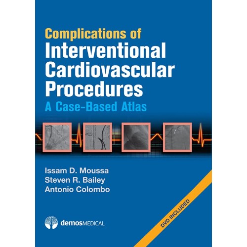 Complications Of Interventional Cardiovascula...